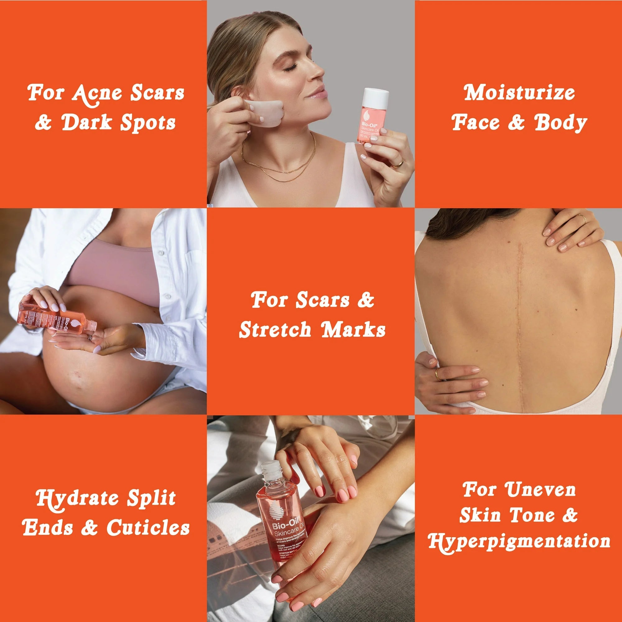 Bio Oil Skincare Body Oil, Serum for Scars and Stretchmarks